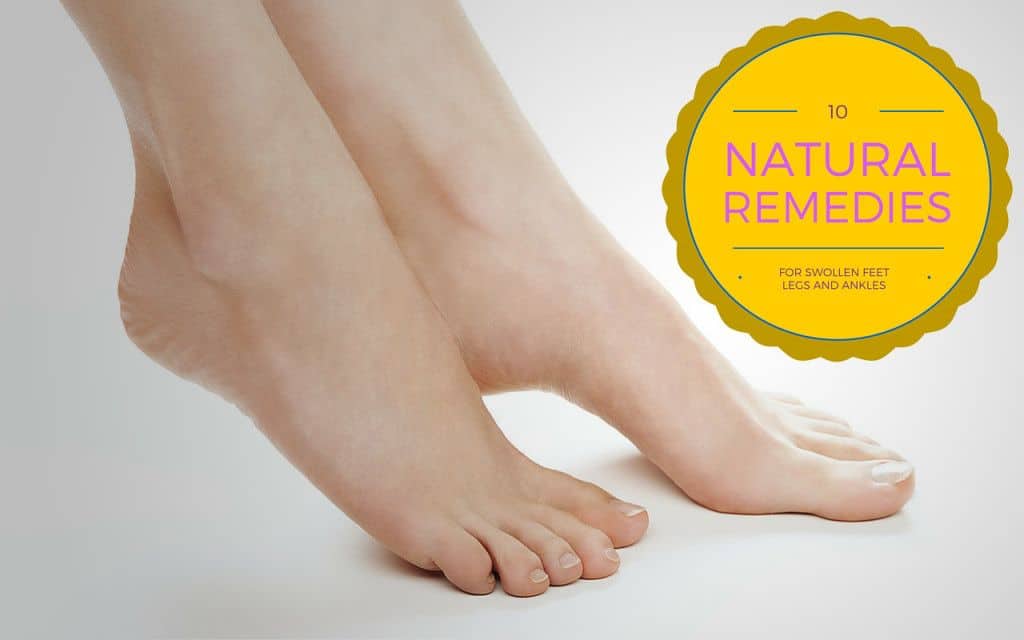 10 Natural Swelling Remedies for Feet, Legs and Ankles