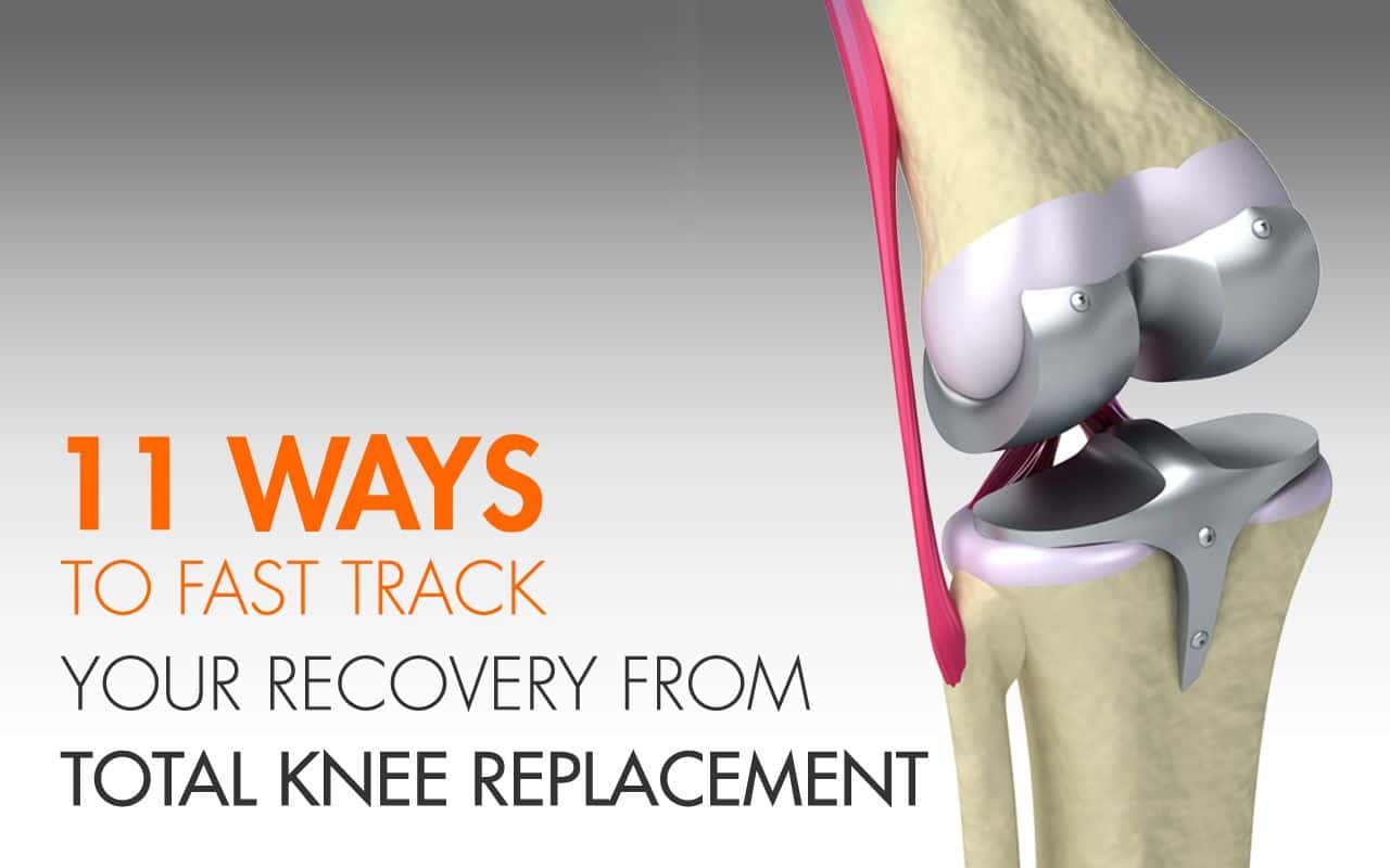 11 Fast Recovery Tips from Total Knee Replacement