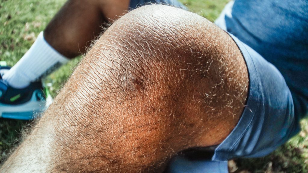 2024 Knee Health FAQs Guide