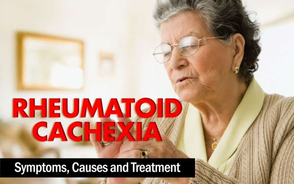 Rheumatoid Cachexia: Symptoms, Causes and Treatment