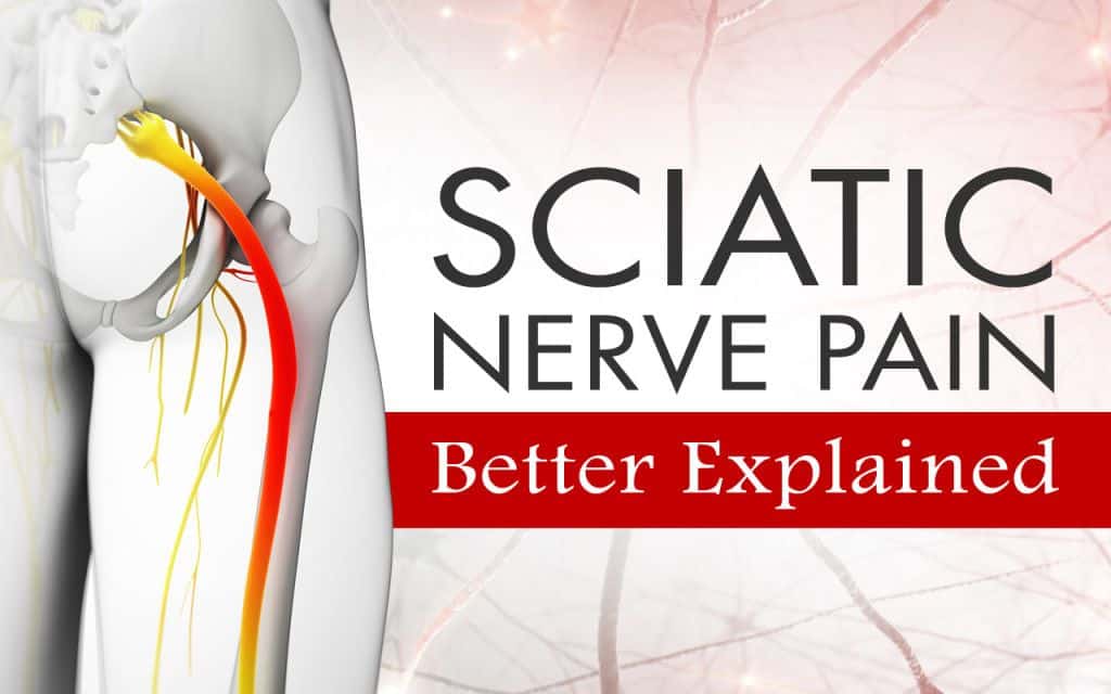 Sciatic Nerve Pain Better Explained