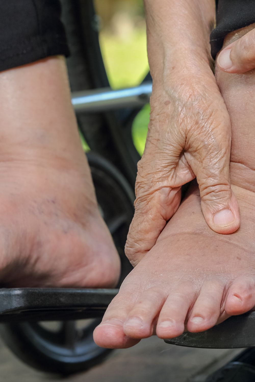 Does Compression Help Achilles Tendonitis and Plantar Fasciitis? What the Evidence Says