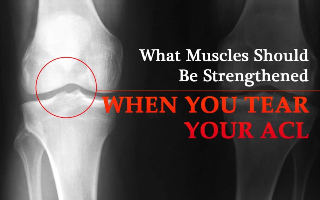 Torn ACL Recovery - Muscle Strengthening Techniques