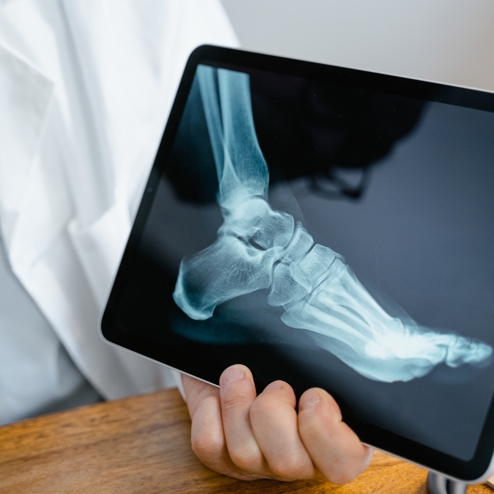 Foot & Ankle Arthritis (Aging Athletes)